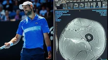 Novak Djokovic đáp trả những chỉ trích với một hành động đặc biệt trước chung kết Úc mở rộng