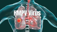 Ấn Độ phát hiện trường hợp đầu tiên nhiễm virus HMPV