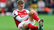 Cabin BLV: Arsenal không lo Odegaard chấn thương