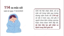 Hà Nội: Số ca mắc sởi vẫn ở mức cao