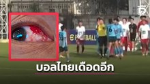 Tức giận vì bị đuổi, cầu thủ Thái Lan đấm trọng tài, hành hung đối phương suýt mù mắt