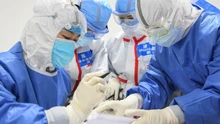 Chủng virus SARS-CoV-2 lưu hành chủ yếu tại Trung Quốc có độc tính thấp