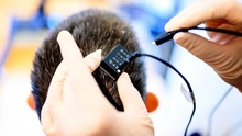 Đột phá thiết bị cấy ghép não AI giúp người câm nói và hát