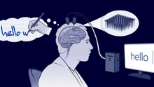 Trí tuệ nhân tạo: Công nghệ AI chuyển sóng não thành văn bản