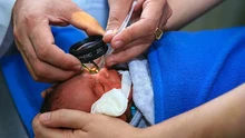 Bệnh lý võng mạc trẻ sinh non