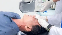 Kịp thời cấp cứu ca bỏng mắt do xăng thơm tại Bến Tre