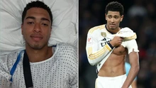 Bellingham chính thức nhập viện, khiến Real Madrid phải lên phương án thay thế
