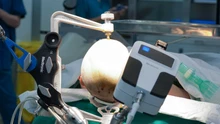 Vinmec tiên phong điều trị động kinh bằng Robot định vị thần kinh hàng đầu thế giới