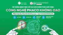 Công nghệ Phaco không dao - bước đột phá trong điều trị đục thủy tinh thể
