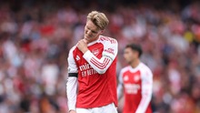 Arsenal dính bão chấn thương ngay trước đại chiến với Liverpool