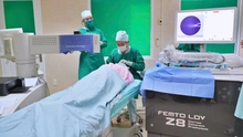 Ứng dụng AI trong y khoa - đột phá trong điều trị đục thủy tinh thể