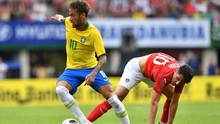 HLV Tite: ‘Brazil vấp ngã vì lo lắng, không phải do Thụy Sĩ chơi rắn’