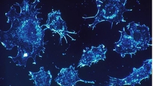 Phát hiện loại protein kích thích sự phát triển của khối u ung thư