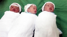 Ba trẻ chào đời khỏe mạnh trong ca sinh tam thai tự nhiên hiếm gặp ở Nghệ An