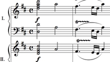 Phát hiện 'chìa khóa' trong bản nhạc của Mozart giúp xoa dịu người bệnh động kinh