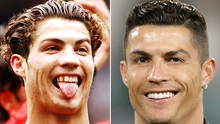 Những sao bóng đá thăng hạng “lên đời” nhờ… chỉnh răng