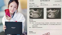 Triệu Lệ Dĩnh đang mang bầu, hình ảnh siêu âm thai nhi bị rò rỉ trên mạng