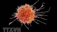 Phát hiện phương pháp mới ngăn chặn sự lây lan của tế bào ung thư não