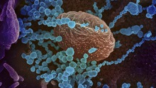 Nhật Bản cảnh báo nguy cơ từ những mầm bệnh mới như virus SARS-CoV-2