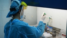 Hai người Nga tái dương tính SARS-CoV-2 đã cho kết quả xét nghiệm âm tính