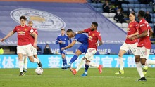 Leicester đã phơi bày sai lầm chuyển nhượng của MU