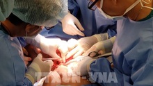 Báo chí quốc tế đưa tin về cuộc phẫu thuật tách rời cặp song sinh dính liền