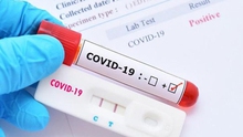 Phát triển bộ xét nghiệm Covid-19 mới có mức độ chính xác tương đương phương pháp PCR