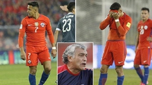Chile phát hoảng với thân hình phì nộn của Alexis Sanchez