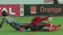 VIDEO: Trọng tài bật khóc trước chấn thương gãy cả 2 chân của thủ môn