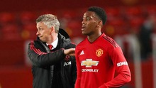 TIẾT LỘ: Chắp tay nhìn đồng đội khởi động, Martial bị HLV Ole Solskjaer ‘sấy tóc’ dữ dội