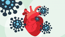 Những điều cần chú ý về sức khỏe tim mạch sau khi mắc COVID-19