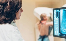 Cảnh báo ung thư vú gia tăng ở phụ nữ dưới 40 tuổi