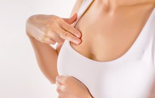 Một phụ nữ bị vỡ túi ngực khi thi đấu pickleball