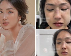 Showbiz Việt 5/12: Sốc với hình ảnh MC Misoa Kim Anh bị bạn trai bạo hành, nhiều đồng nghiệp lên tiếng bảo vệ