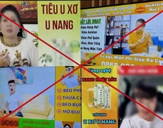 Báo động người nổi tiếng quảng cáo “nổ”
