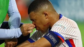 Báo Pháp cập nhật mới nhất tình trạng của Mbappe, phải ngồi ngoài lâu hơn dự kiến 
