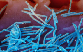 Pháp ghi nhận ca nhiễm virus hiếm gặp ở người
