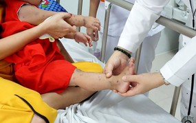 Hà Nội mở đợt cao điểm phòng chống bệnh tay chân miệng trong trường học