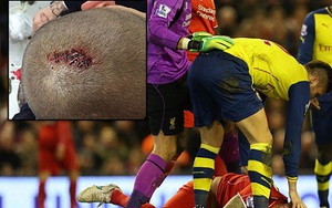 CẬP NHẬT tin tối 22/12: Skrtel phải khâu 8 mũi ở đầu. Ronaldo muốn tiếp tục vô địch Champions League