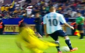 Cú tắc bóng khủng khiếp nhất mùa giải đến từ một trận... giao hữu