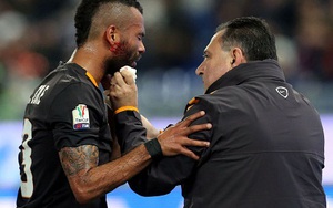 Ashley Cole phải rời sân sau pha va chạm khủng khiếp