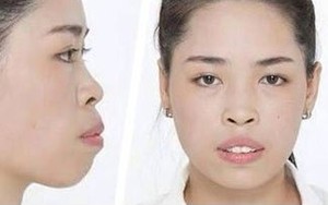 Chương trình 'Thay đổi cuộc sống': Không phải mọi nhân vật đều thay đổi hoàn toàn diện mạo