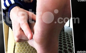 Barcelona: Ai đã gây ra chấn thương của Lionel Messi?