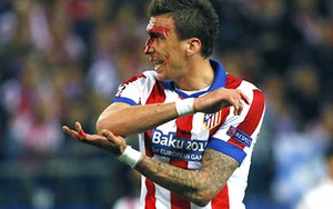 Dù có đổ máu, Mandzukic chẳng hề sợ Real