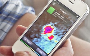 Chẩn đoán ung thư nhanh qua smartphone