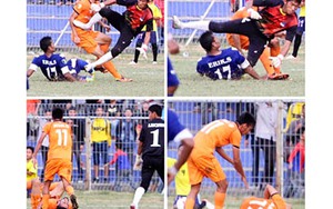 Chấn thương và cách xử lý kiểu 'ao làng'