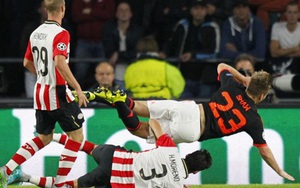 Luke Shaw tung ảnh chân bị băng bó lên mạng