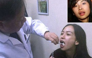 Sau cưới, Angelababy vội vã kiểm tra y tế xóa bỏ tin đồn phẫu thuật thẩm mỹ