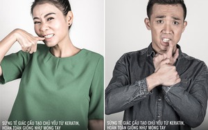 Thu Minh, Trấn Thành, Phương Mỹ Chi... cắn móng tay bảo vệ tê giác