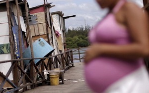 KÌ DIỆU: Bà bầu Mexico nhiễm virus Zika vẫn sinh con khỏe mạnh